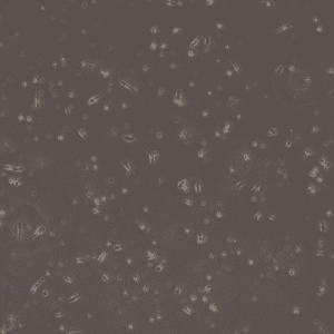 Hofbauer Cells (Macrophages)